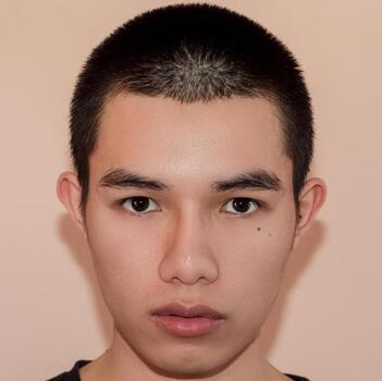 After Psoriasis Treatment