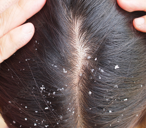 Before Hair Treatment